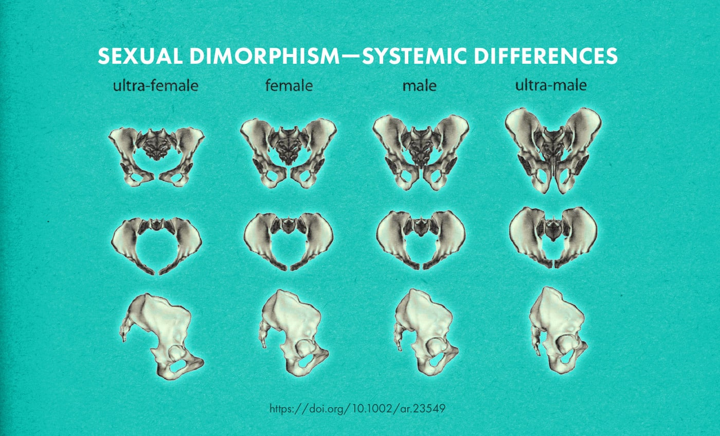 Female Hip Bone Shape, Male Hip Bone Shape, and their differences