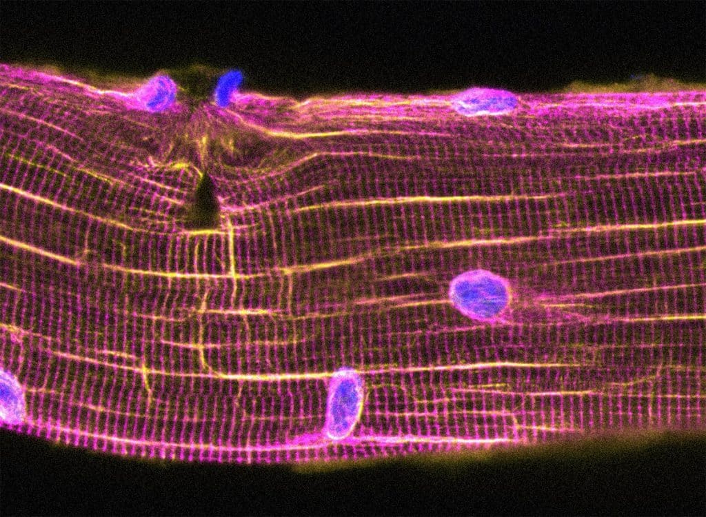 Muscle Repair Nuclei